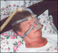 The Nasal CPAP mask